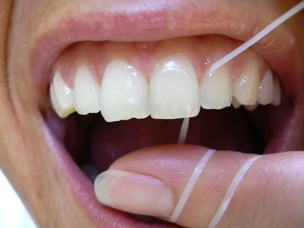 Anwendung von Zahnseide